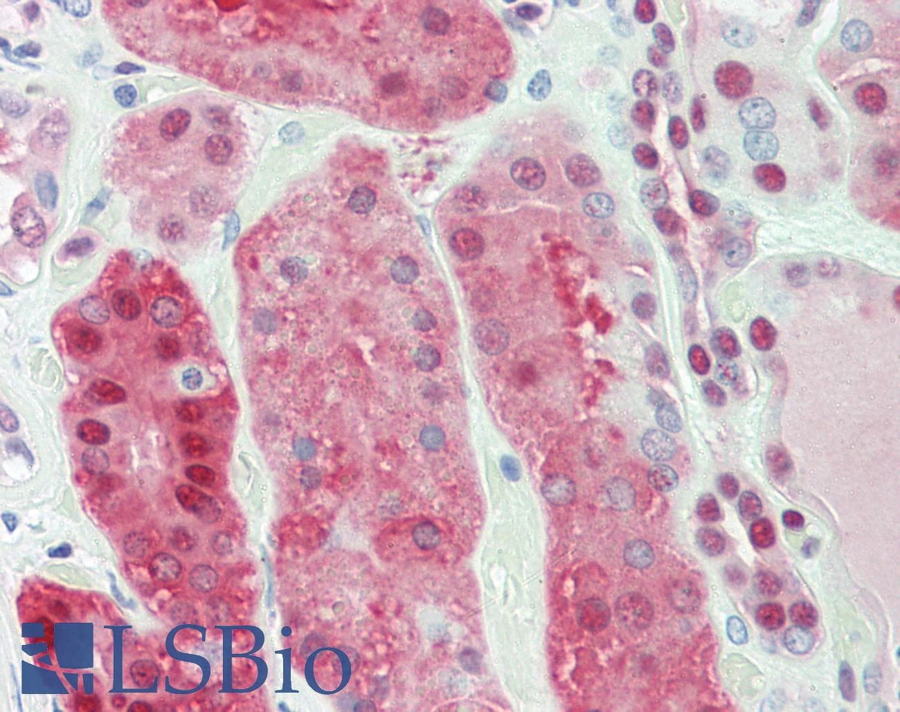PNP / Nucleoside Phosphorylase Antibody (aa68-289)