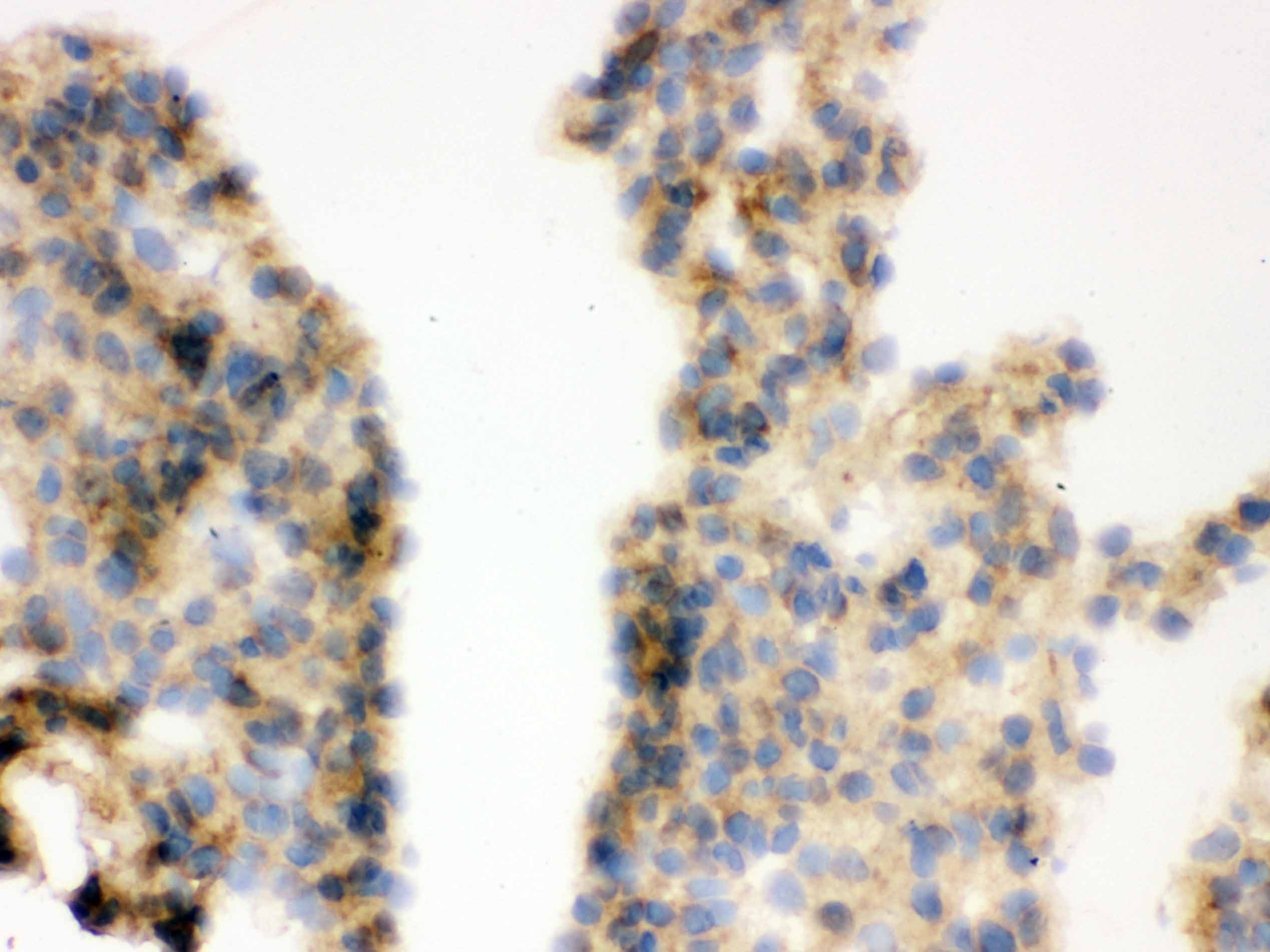 COMT Antibody (aa52-271)
