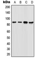 FOXM1 Antibody (Internal)