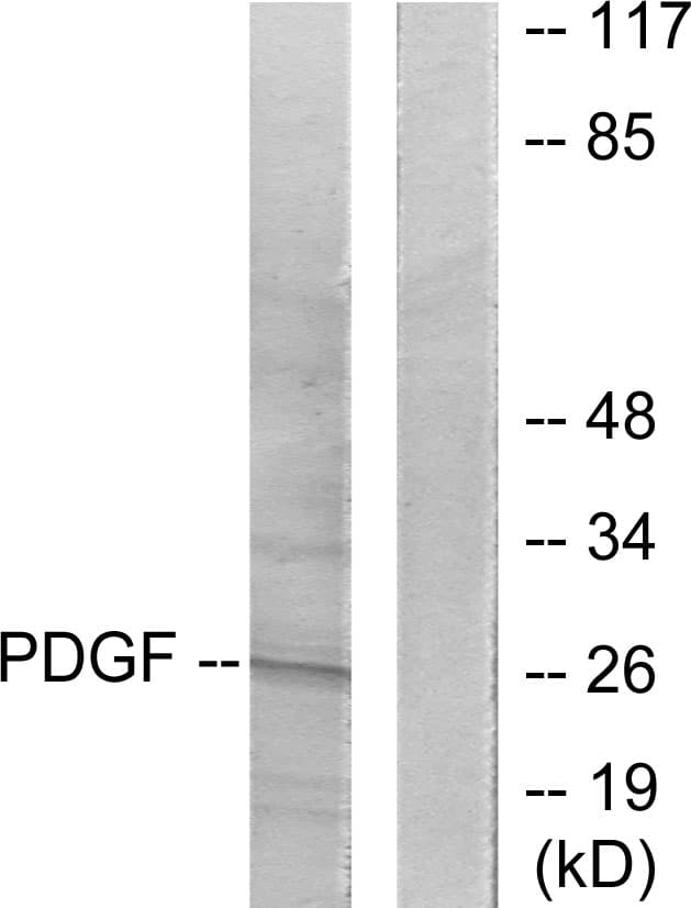 PDGF-BB Antibody (aa16-65)