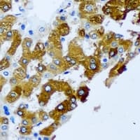 Polyclonal Rabbit anti-Human KIF3A Antibody (IHC, IF, WB)