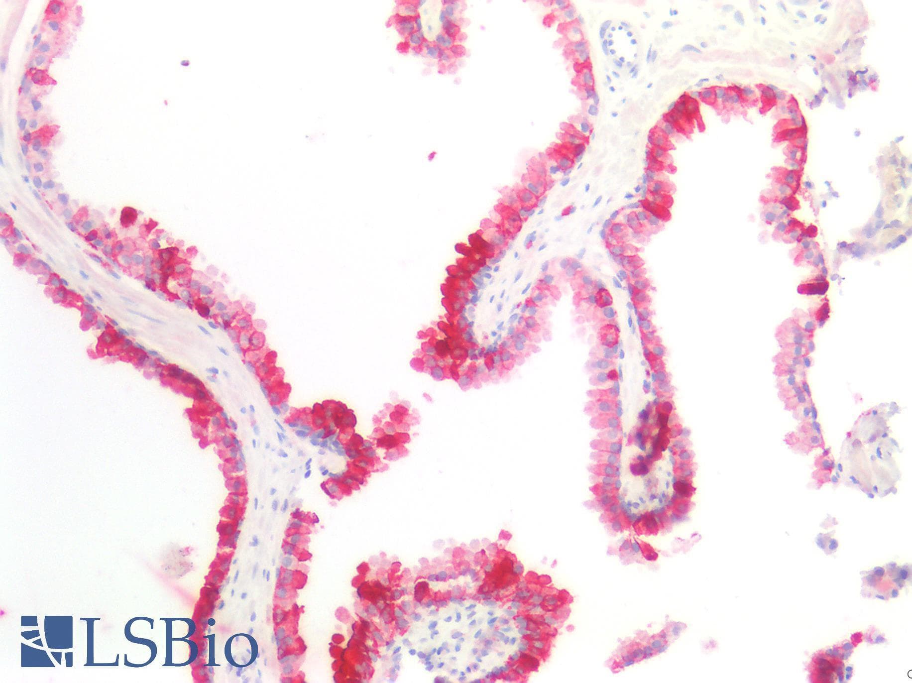Monoclonal Mouse anti-Human ST6GAL1 / CD75 Antibody (clone LN-1, IHC)