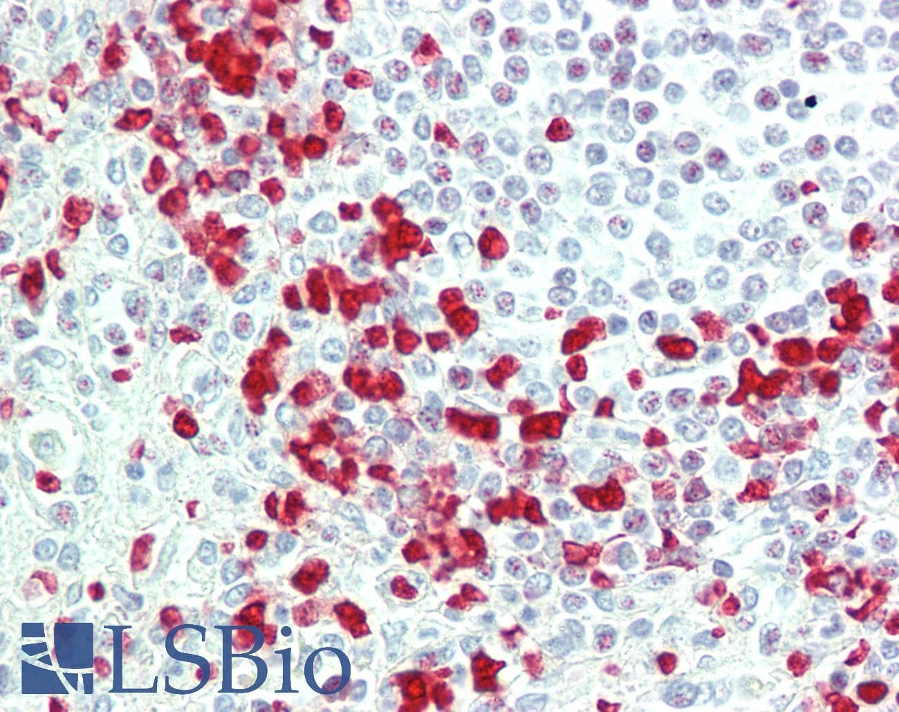 IHC-plus™ Polyclonal Rabbit anti-Human WNT4 Antibody (aa242-269, IHC, WB)