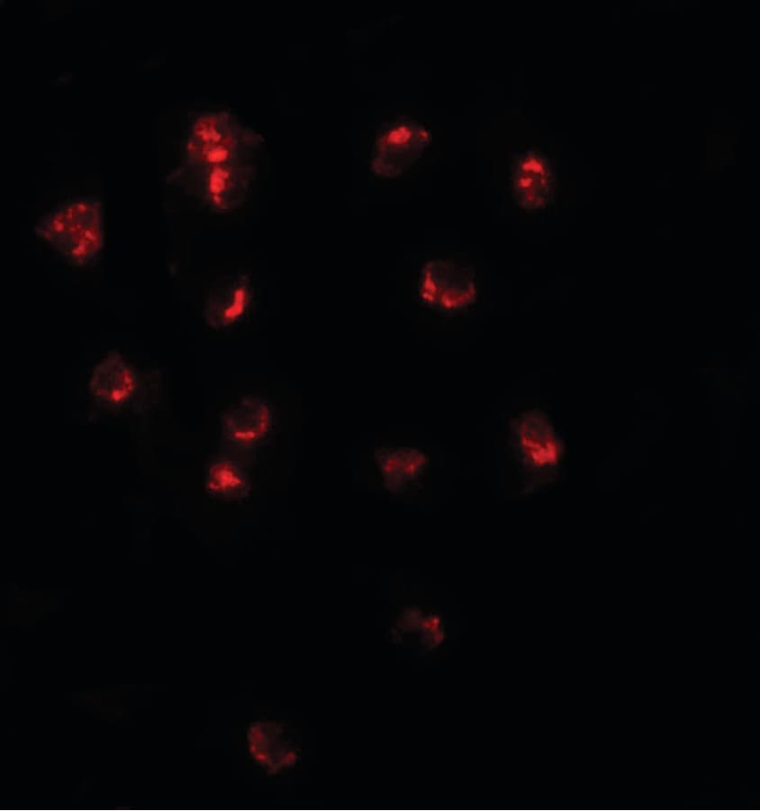IHC-plus™ Polyclonal Rabbit anti-Human TSHZ1 Antibody (IHC, IF, WB)