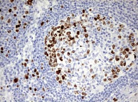 TOP2A / Topoisomerase II Alpha Antibody (aa1100-1531, clone OTI1D5)