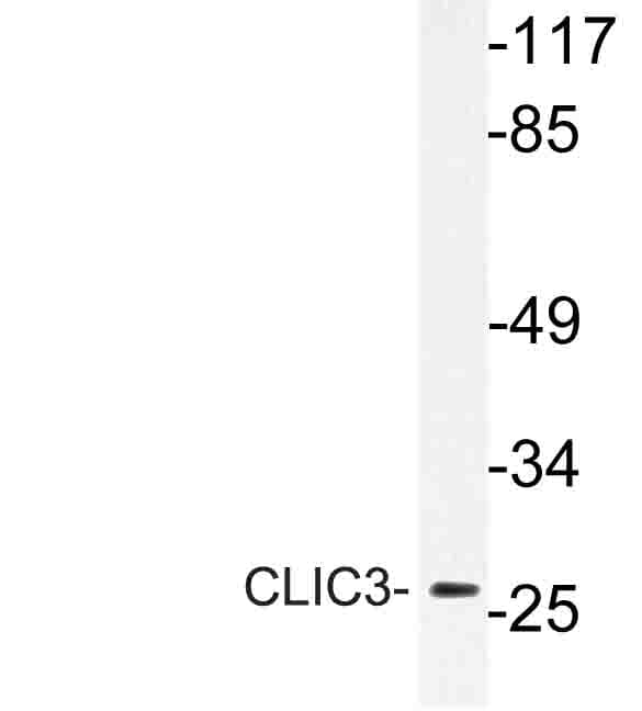 CLIC3 Antibody (Phe56)