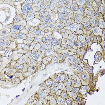 CD44 Antibody