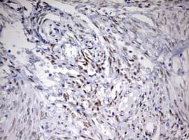 TOP2A / Topoisomerase II Alpha Antibody (aa1100-1531, clone OTI5E6, Carrier-free)