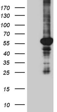PPARD / PPAR Delta Antibody (aa1-244, clone OTI2D2, Carrier-free)