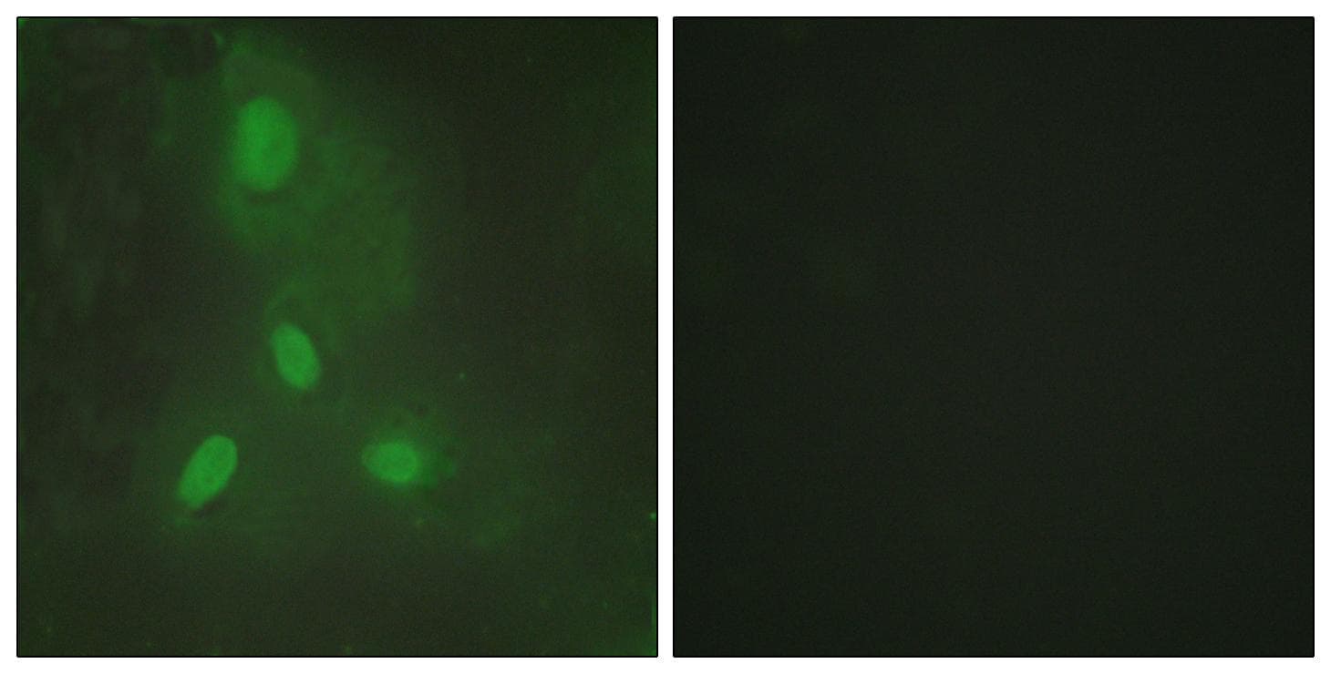 BACH1 Antibody