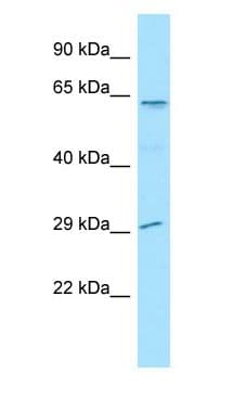 LGI4 Antibody (aa323-372)