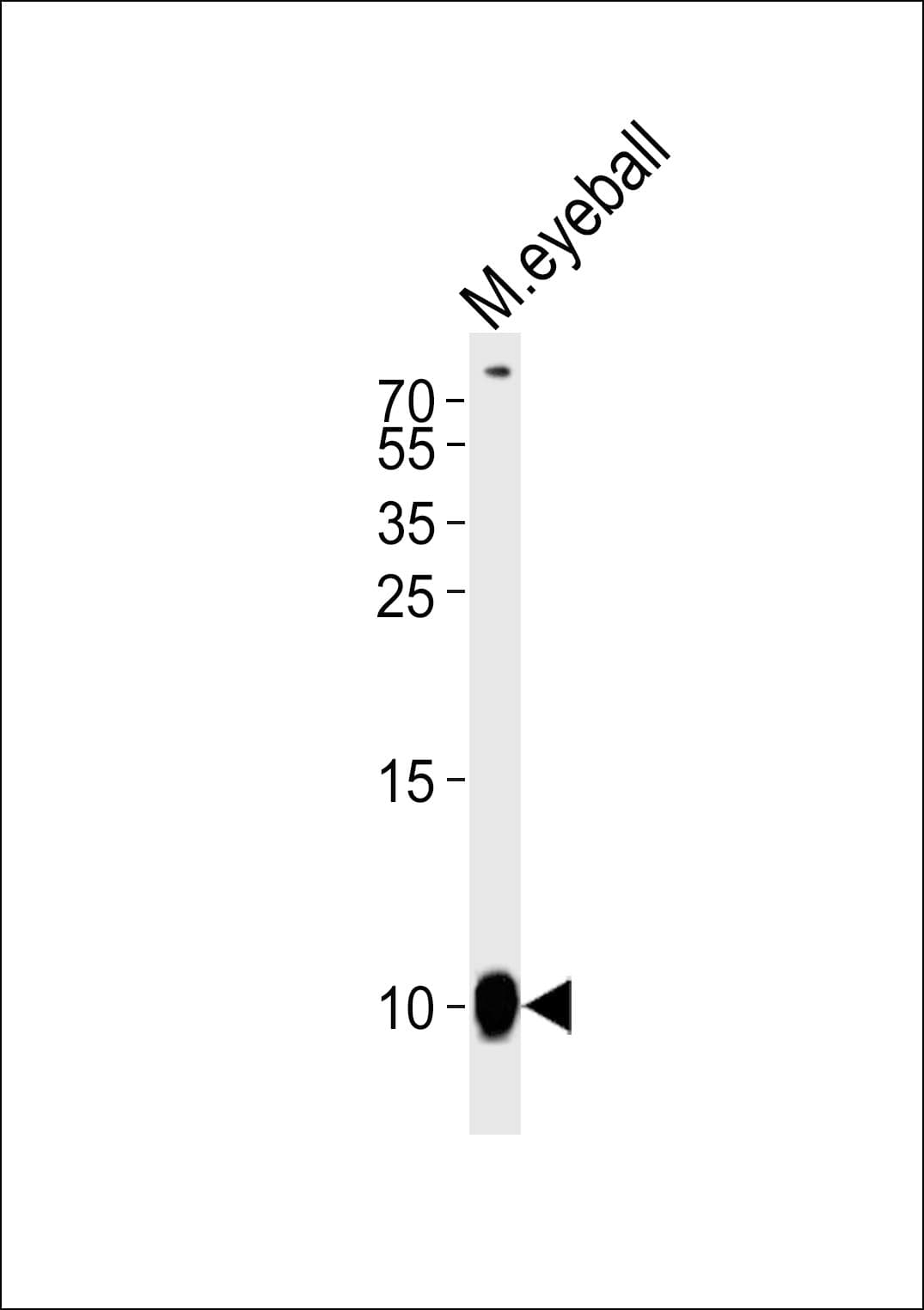 GNGT1 Antibody (aa56-91)
