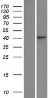 TPST1 Protein (Over-Expression Lysate Myc-DDK (Flag))