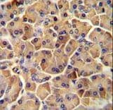 Polyclonal Rabbit anti-Human SEL1L Antibody (aa156-182, IHC, WB)