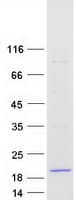 Human FXYD6 Protein (Recombinant Myc-DDK (Flag))