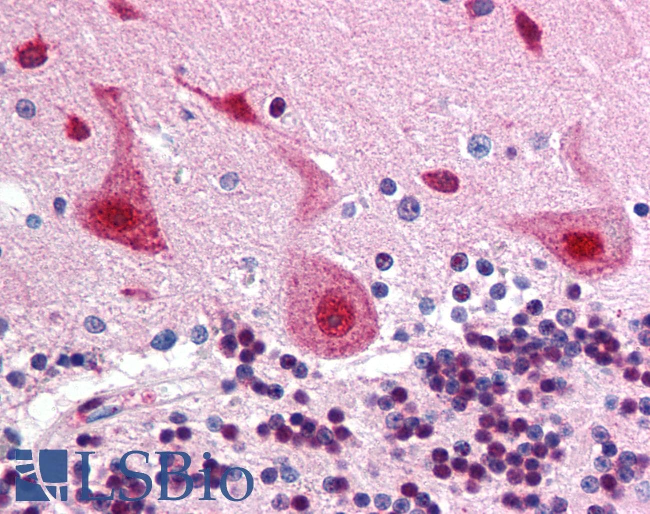 IHC-plus™ FANCA Antibody