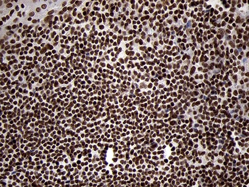 SMC1A / SMC1 Antibody (aa889-1016, clone OTI3G4, Carrier-free)