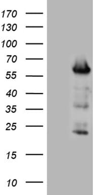Monoclonal Mouse anti-Human FOXO4 / AFX1 Antibody (clone OTI8F1, aa206-505, WB)