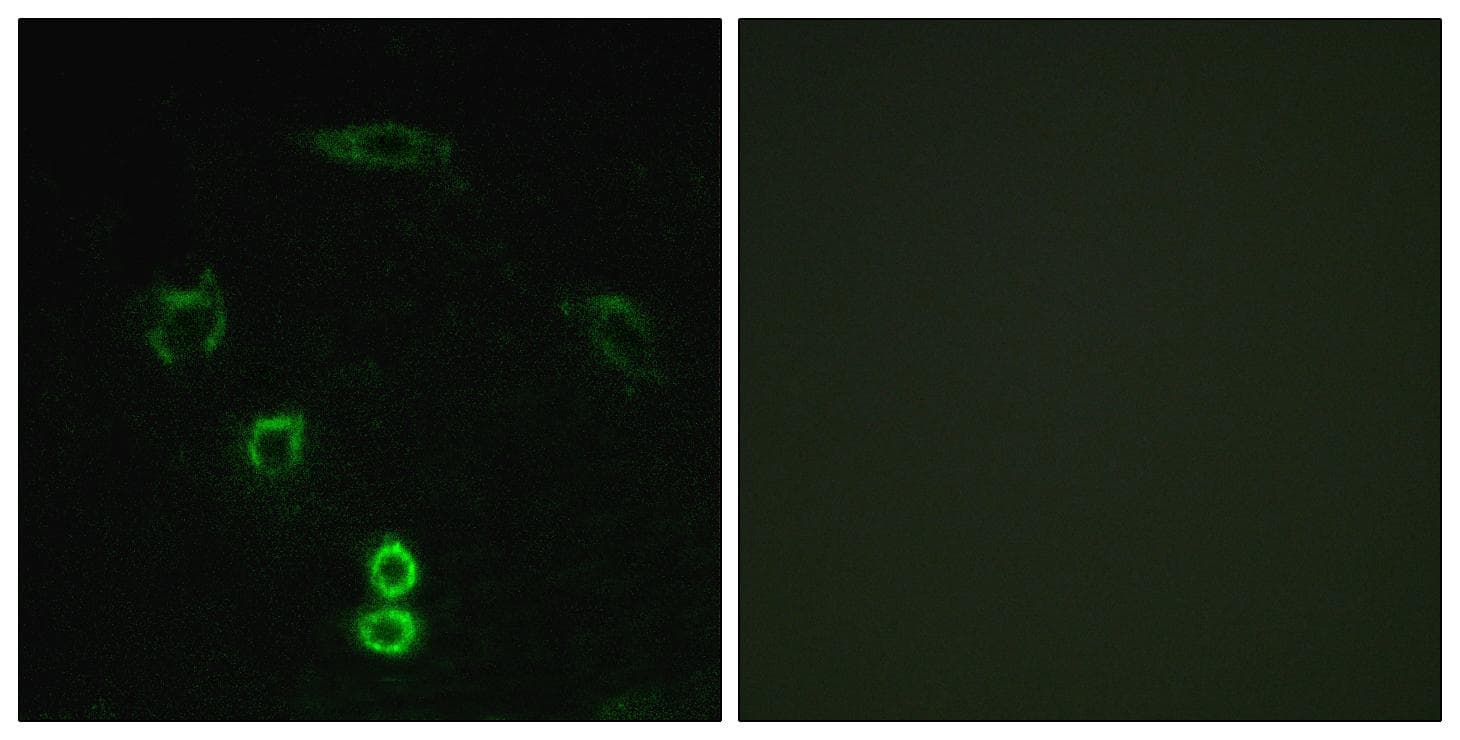 GLYCTK / Glycerate Kinase Antibody