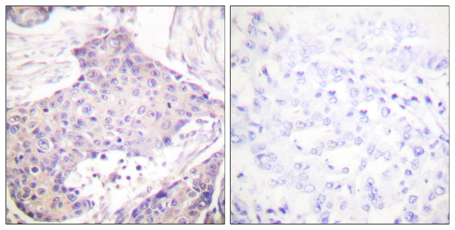 Polyclonal Rabbit anti-Human CARD6 Antibody (IHC, IF, WB)
