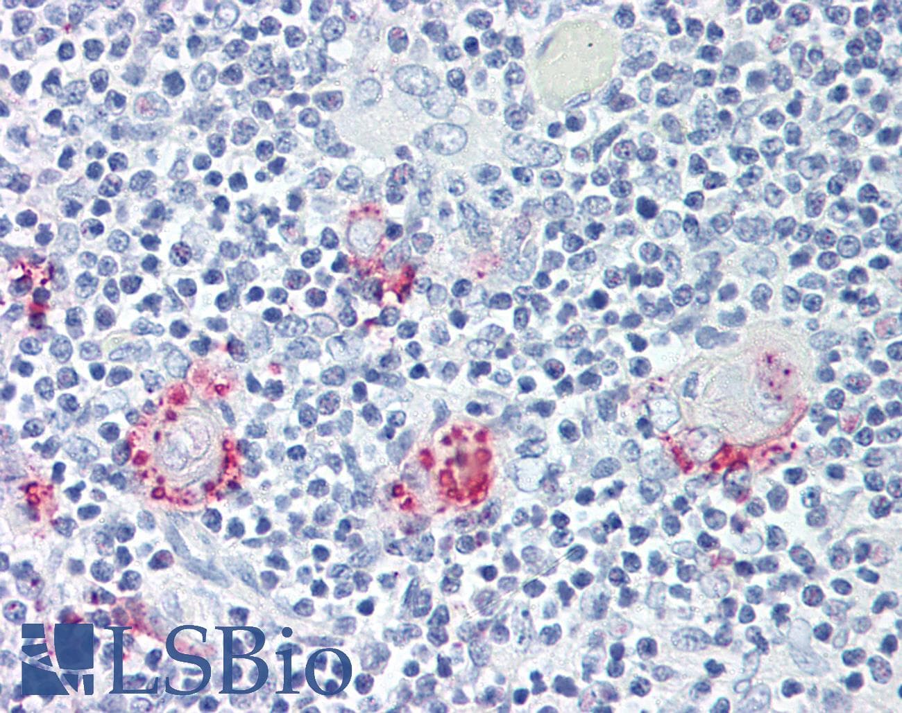 IHC-plus™ RORC / ROR Gamma Antibody (Ligand-binding Domain)