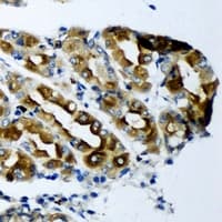 KCNN3 / SK3 Antibody