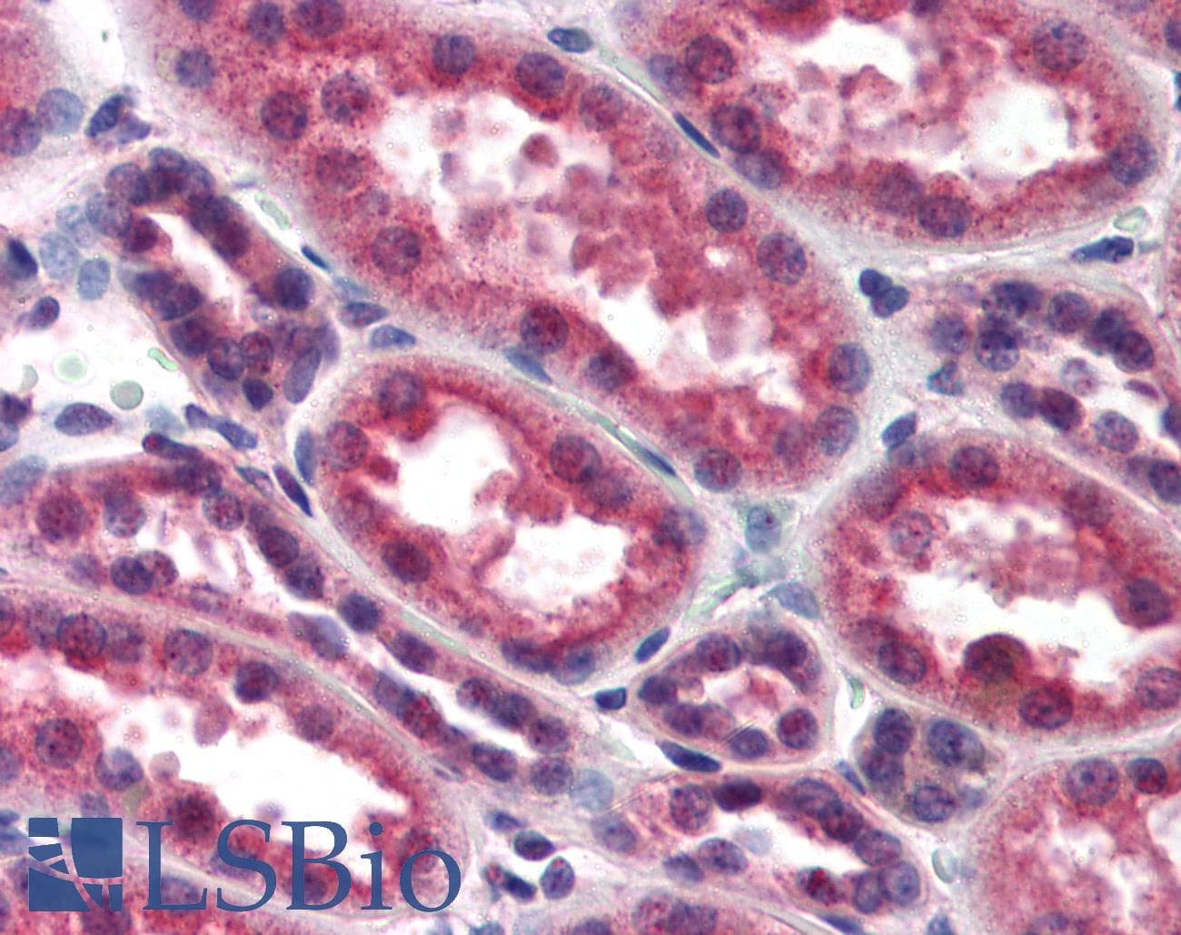 IHC-plus™ Polyclonal Rabbit anti-Human CHUK / IKKA / IKK Alpha Antibody (C-Terminus, IHC, WB)