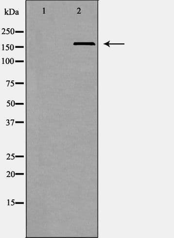 Polyclonal Rabbit anti-Human SMARCA4 / BRG1 Antibody (IHC, WB)