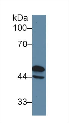 GFAP Antibody (aa113-211)