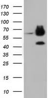 EPHX2 / Epoxide Hydrolase 2 Antibody (clone OTI1H5)