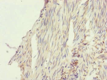 SFI1 Antibody