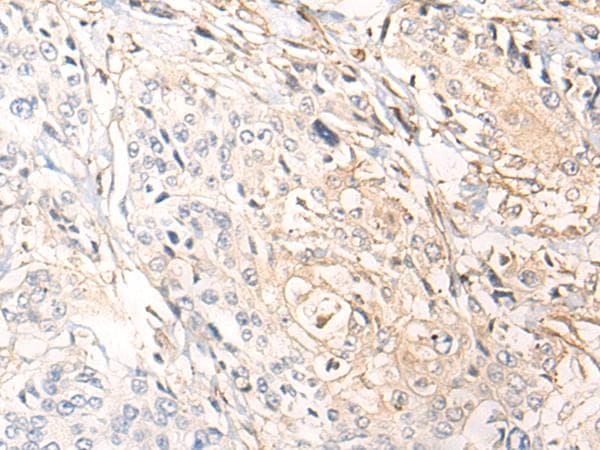 C5orf13 Antibody