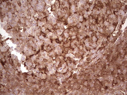 LGALS9 / Galectin 9 Antibody (clone OTI1D12)