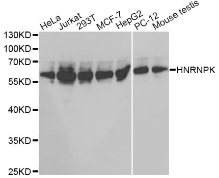 Polyclonal Rabbit anti-Human HNRNPK / hnRNP K Antibody (IHC, IF, WB)