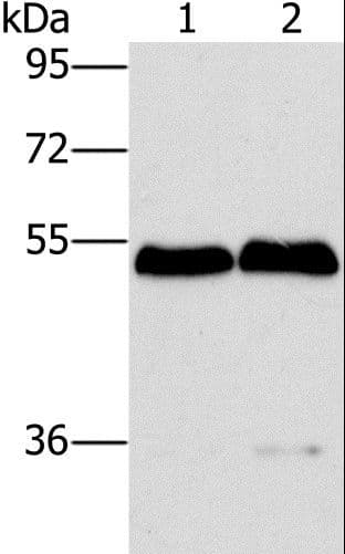 SPHK2 Antibody