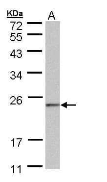 Polyclonal Rabbit anti-Human C6orf66 Antibody (aa1-175, WB)