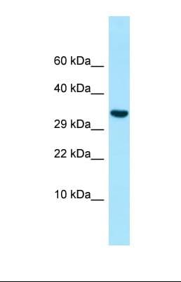 INHBC Antibody (aa66-115)