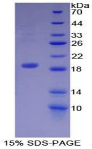 Human DCD / Dermcidin Protein (Recombinant His, N-Terminal)