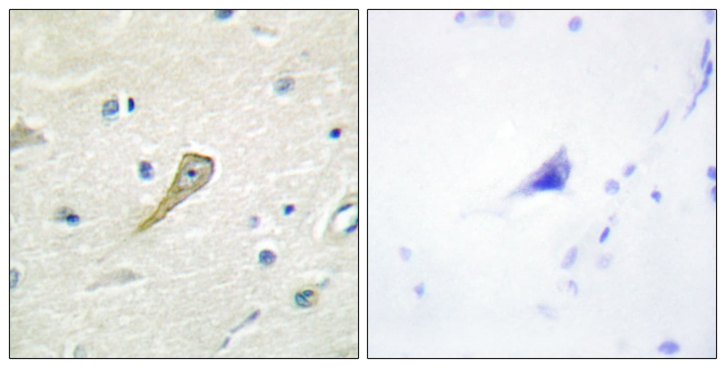 SEMA4A / Semaphorin 4A Antibody (aa501-550)