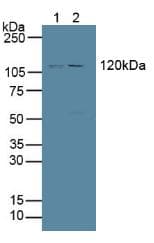 PTPRH / SAP-1 Antibody (aa844-1096)
