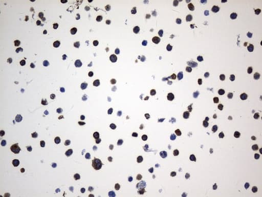 CD74 / CLIP Antibody (clone UMAB231)