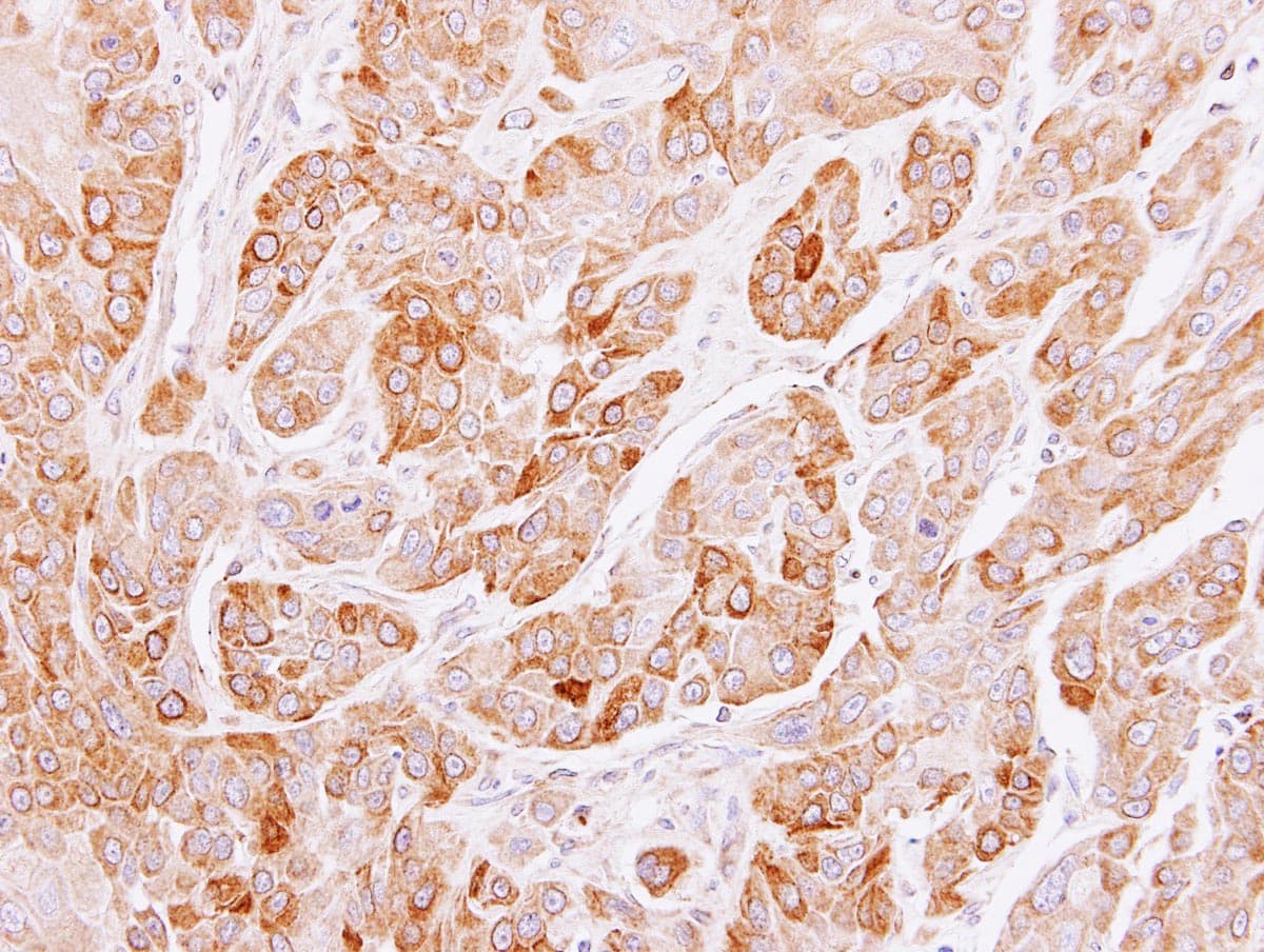 PEF1 Antibody (aa77-284)
