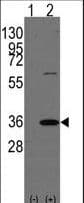Polyclonal Rabbit anti-Human Prohibitin 2 / PHB2 Antibody (aa66-95, IHC, WB)