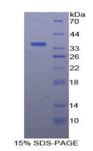 Human HSF1 Protein (Recombinant His-T7)