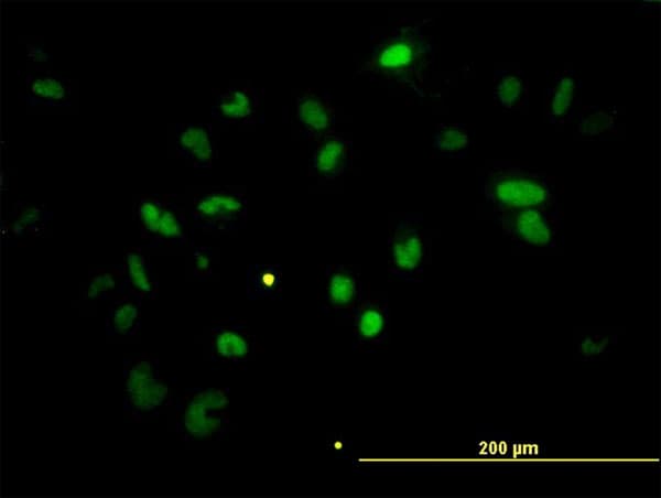 IHC-plus™ CHEK2 / CHK2 Antibody (clone 4B7)