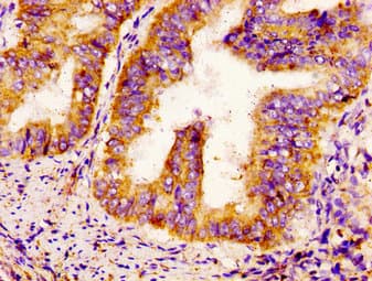 SCN9A / Nav1.7 Antibody