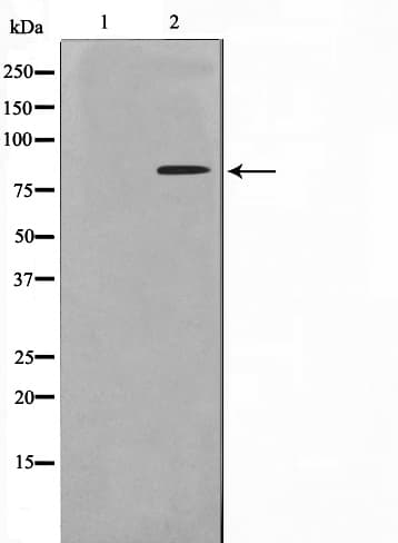 NBN / Nibrin Antibody (phospho-Ser278)