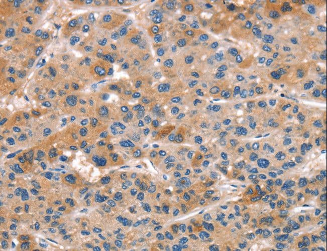 ALOX15 / 15-Lipoxygenase Antibody