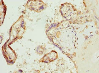 Polyclonal Rabbit anti-Human COX10 Antibody (IHC)