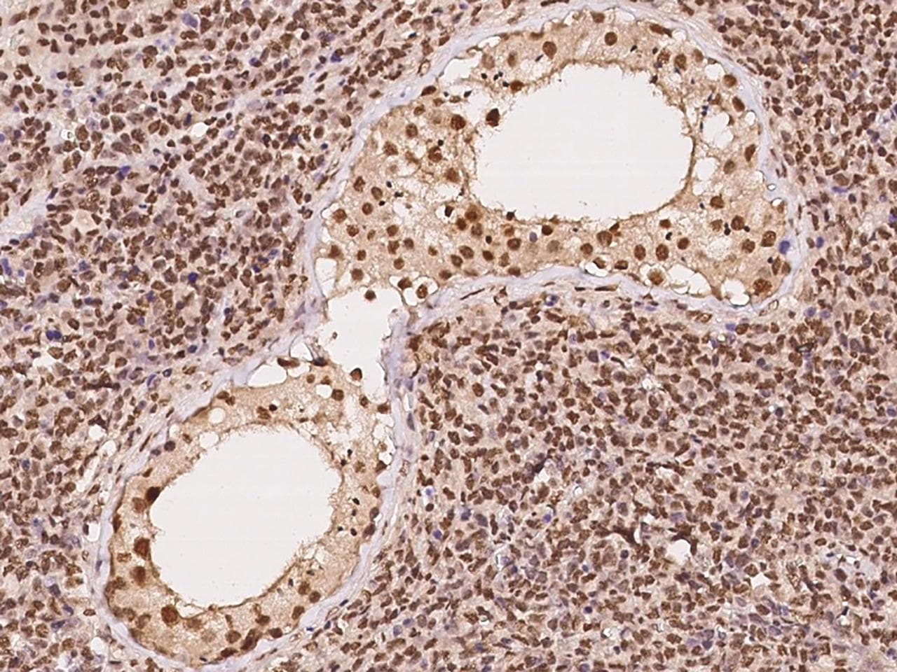 CUTC Antibody